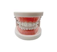 Standard Orthodontic Teeth Model, YOUYA DENTAL Demonstration Orthodontic Model Teeth Teach Study Tools with All Mouth Ceramic Bracket
