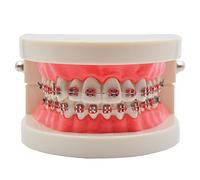 Standard Tooth Teaching Mallocclusion Orthodontic Teeth Model with Brackets Archwire Buccal Tube Tool