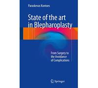 State of the art in Blepharoplasty: From Surgery to the Avoidance of Complications