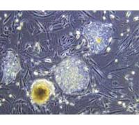Stem Cells