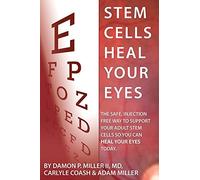 Stem Cells Heal Your Eyes: Prevent and Help: Macular Degeneration, Retinitis Pigmentosa, Stargardt, Retinal Distrophy, and Retinopathy.