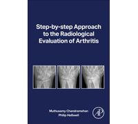 Step-by-step Approach to the Radiological Evaluation of Arthritis