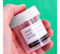 Sterilin Urine Collection Sample Bottles Specimen Storage Pot Graduated Plastic Container with Lid for Urine Medical Collection Volume-60ml - Pack of 10