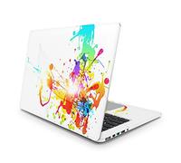 Sticker Master Abstract Splatters Laptop Vinyl Sticker Skin Cover 13 14 15 Inch Notebook Decal for MacBook Asus Acer Hp Lenovo Huawei Dell Ms Toshiba 14 inch (35x26 cm)