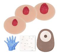 Sticky Ileostomy Simulators, Stoma Training Model Set, Multi-Skin Tone Ostomy Care Practice Models for Medical Training and Patient Education - Light