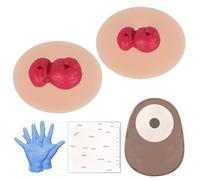 Sticky Loop Ileostomy Simulators, Stoma Training Model Set, Multi-Skin Tone Ostomy Care Practice Models for Medical Training and Patient Education - Light