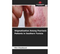 Stigmatization Among Psoriasis Patients in Southern Tunisia