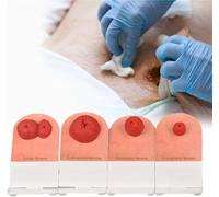 Stoma Training Model Set, 4pcs Ostomy Care Training Kit, Wound Care Models, Tabletop Simulation Fecal Ostomy Model, for Use by Medical Educators and First Aid Training.