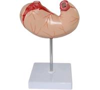 Stomach Anatomy Model Human Digestive System Organ Stomach Structure Movable Stomach Anatomy Model for Medical Education and Training