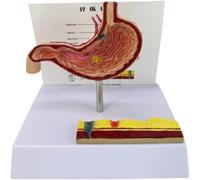 Stomach Anatomy Model, Pathological Stomach Perforation Model for Clinical Teaching, PVC Material Human Organ Model for Lectures and Reports