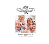 Stop Painful Abscessed Teeth and Gum Disease that Leads to Alzheimer's Now.: Volume 1 (Prevention and Reversal)