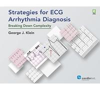 Strategies for ECG Arrhythmia Diagnosis: Breaking Down Complexity
