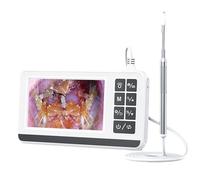 STREAMVOY Digital Otoscope with HD Camera, 3.5" LCD Screen & 2500mAh Battery, Plug and Play Ear Inspection Tool for Home/Clinic Use, Compatible with Windows/Android