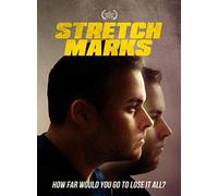 Stretch Marks
