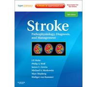 Stroke: Pathophysiology, Diagnosis, and Management