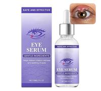Stye Eye Treatment, Under Eye Serum for Styes Chalazion Blepharitis Treatment, Natural Stye Eye Serum for Styes, Fast Acting Restore Healthy Eye Skin, 30ML