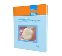 Successful Posterior Composites (Quintessentials of Dental Practice)