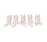 SUPYINI Imitation Garlic Toy Mini Artificial Garlic Props DIY Decoration, 5 Pieces for 1:12 Dollhouse, Small and Sensitive, Safe and, the Interest of the