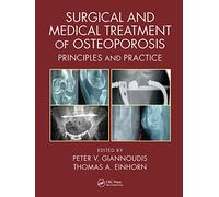 Surgical and Medical Treatment of Osteoporosis: Principles and Practice