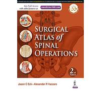 Surgical Atlas of Spinal Operations