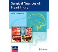 Surgical Nuances of Head Injury
