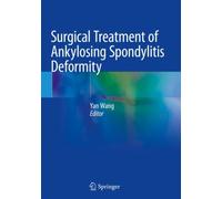 Surgical Treatment of Ankylosing Spondylitis Deformity