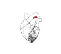 Swans - The Beggar [VINYL]