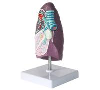 SWENEEN Model of a Smoke Lung 2:3 Human Lung Anatomical Model wirh Pathological Features & Clear Texture & Accurate Anatomy Structure for Teaching