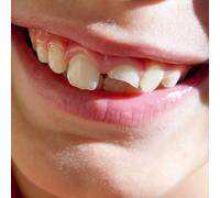 SWIMMING PAUL - SMILING THROUGH THE PAIN [VINYL]