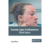 Systemic Lupus Erythematosus: Clinical Aspects