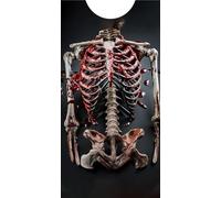 TABARDO! Ribcage. Blood-Spattered Effect, Fancy Dress, Over-the-Head Design, (Large)