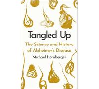 Tangled Up: The History and Science of Alzheimer's Disease