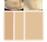 Tattoo Cover Up Patch - Tattoo Cover Up Tape - Waterproof, Ultra-Thin Scar Patch for Tattoos, Scars & Birthmarks. Sweatproof, Breathable Concealer Sticker Blends Seamlessly with Natural Skin Tone 15p