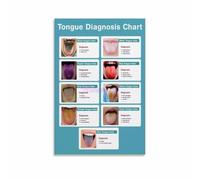 TCM Diagnostic Poster Tongue Examination Chart Acupuncture Clinic Decor | Essential reference for acupuncturists herbalists and holistic health practitioners(Unframed,12x18inch(30x45cm))