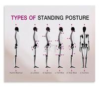 TCYNNQVD Standing Posture Disorders Visual Guide Poster Back Health Education for Living Room Bedroom Wall-Art(Framed,16x24inch(40x60cm))