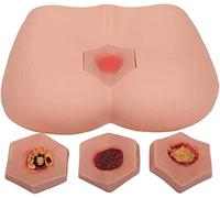 Teaching Model,Care of Decubitus Ulcers Model 4 Stages of Bedsores Pressure Sore Model Decubitus Ulcer Training Model Decubitus Wound Care Kit
