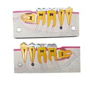 Teaching Model tool,Dental Teeth Model Detailed Study Analysis Dental Implants Development Demonstration Model for Dental Education