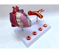 Teaching Model Tools Heart Anatomy Heart Coronary Artery Bypass Model with Arterial And Blood Vessel Blockage Thrombosis Aids