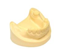 Teeth Implant Model - Simulated Oral Tooth Mandibular Missing Practice Exercise Silicone Suture for Teaching Study Display