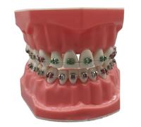 Teeth Model 3.0x2.4 Inch Realistic Typodont Dental Model with Metal Wires and Bracket for Children and Adults, Dentist Training Tool and Education Display