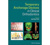 Temporary Anchorage Devices in Clinical Orthodontics