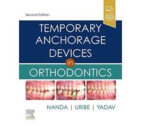 Temporary Anchorage Devices in Orthodontics
