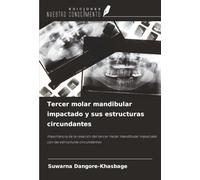 Tercer molar mandibular impactado y sus estructuras circundantes: Importancia de la relación del tercer molar mandibular impactado con las estructuras circundantes