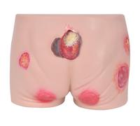 TGPSMDXKV Advanced Pressure Ulcers Nursing Model Pressure Ulcer Models of Different Degrees Elder Butt Model for Education Teaching Medical Training