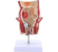 TGPSMDXKV Human Pathologies Model Human Rectum Model Ornaments Human Anatomical Model Medicals Tool for Teaching