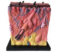 TGPSMDXKV Skin Acne Model, Human Skin Anatomy Model, 80X Acne Epidermis Anatomy Dermis Skin Fat Anatomy Suitable for Doctor's Office