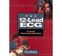 The 12-Lead ECG in Acute Myocardial Infarction