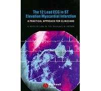The 12 Lead ECG in ST Elevation Myocardial Infarction: A Practical Approach for Clinicians