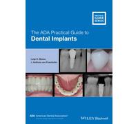 The ADA Practical Guide to Dental Implants