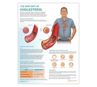 The Anatomy of Cholesterol Poster, 45x60cm,18x24 inches, Heart Disease Chart, Lowering Cholesterol Wall Diagram